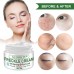 Freckle Cream by SCOBUTY - Removes Freckle & Dark Spots Shop in Pakistan