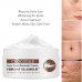 Best Scar Removal Cream For Old Scars, Stretch Marks, Burns Repair,Face Skin Repair USA made Sale in Pakistan