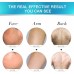 Hair Inhibitor Spray Natural Hair Stop Growth Spray For Arm Underarm Legs Face Back Leg Chest Bikini Shrink Pores No leave Black Spot And Smooth For Men Women