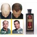 Hair Nurturing Anti Hair Loss Shampoo Available at Online Sale in Pakistan