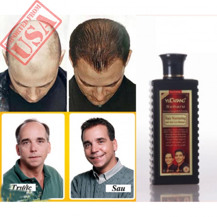 Hair Nurturing Anti Hair Loss Shampoo Available at Online Sale in Pakistan